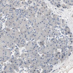 Invitrogen ALPL Polyclonal Antibody 100 μL; Unconjugated:Antibodies,