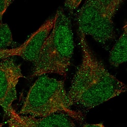 Invitrogen CNTLN Polyclonal Antibody 100 μL; Unconjugated:Antibodies,