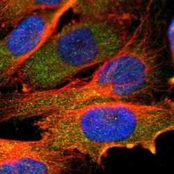 Invitrogen USP2 Polyclonal Antibody:Antibodies:Primary Antibodies