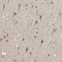 Invitrogen USP2 Polyclonal Antibody:Antibodies:Primary Antibodies