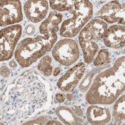 Invitrogen USP2 Polyclonal Antibody:Antibodies:Primary Antibodies