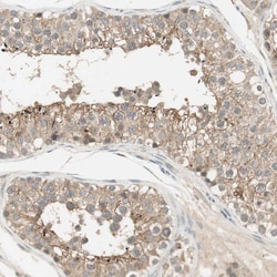 Invitrogen USP2 Polyclonal Antibody:Antibodies:Primary Antibodies