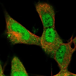 Invitrogen RBP1 Polyclonal Antibody 100 &mu;L; Unconjugated:Antibodies,