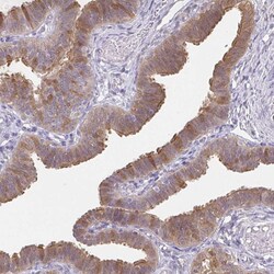 Invitrogen RBP1 Polyclonal Antibody 100 &mu;L; Unconjugated:Antibodies,