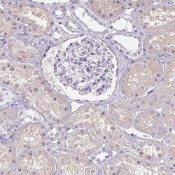 Invitrogen RBP1 Polyclonal Antibody 100 &mu;L; Unconjugated:Antibodies,