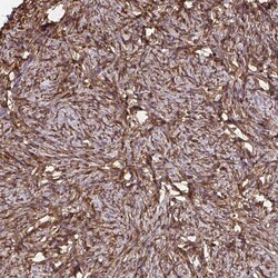 Invitrogen RBP1 Polyclonal Antibody 100 &mu;L; Unconjugated:Antibodies,