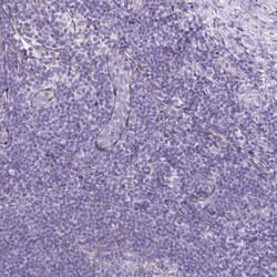 Invitrogen RBP1 Polyclonal Antibody 100 &mu;L; Unconjugated:Antibodies,