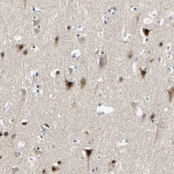 Invitrogen MARK1 Polyclonal Antibody 100 &mu;L; Unconjugated:Antibodies,