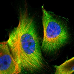 Invitrogen S100A6 Polyclonal Antibody 100 &mu;L; Unconjugated:Antibodies,