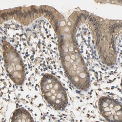 Invitrogen S100A6 Polyclonal Antibody 100 &mu;L; Unconjugated:Antibodies,