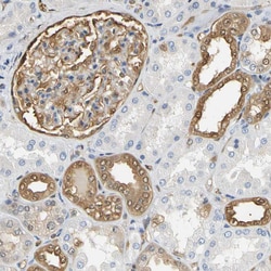 Invitrogen S100A6 Polyclonal Antibody 100 &mu;L; Unconjugated:Antibodies,
