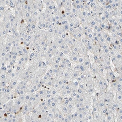 Invitrogen S100A6 Polyclonal Antibody 100 &mu;L; Unconjugated:Antibodies,
