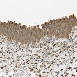 Invitrogen S100A6 Polyclonal Antibody 100 &mu;L; Unconjugated:Antibodies,