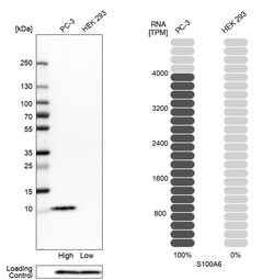 Invitrogen S100A6 Polyclonal Antibody 100 &mu;L | Buy Online | Invitrogen&trade; | Fisher Scientific