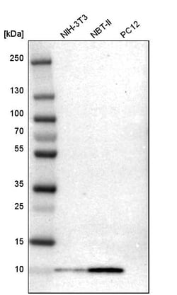 Invitrogen S100A6 Polyclonal Antibody 100 &mu;L | Buy Online | Invitrogen&trade; | Fisher Scientific