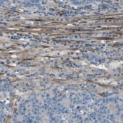 Invitrogen Collagen III Polyclonal Antibody 100 &mu;L; Unconjugated:Antibodies,