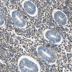 Invitrogen Collagen III Polyclonal Antibody 100 &mu;L; Unconjugated:Antibodies,