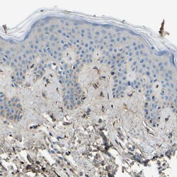 Invitrogen Collagen III Polyclonal Antibody 100 &mu;L; Unconjugated:Antibodies,