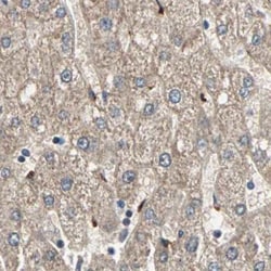 Invitrogen Protein S Polyclonal Antibody 100 &mu;L; Unconjugated:Antibodies,