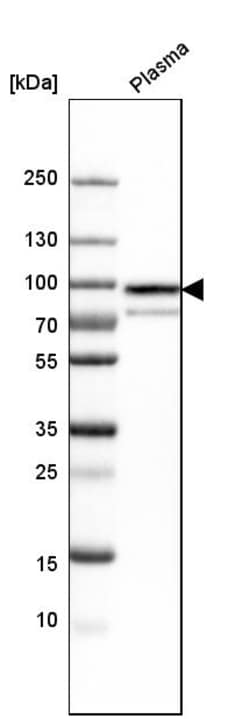 Invitrogen Protein S Polyclonal Antibody 100 &mu;L; Unconjugated:Antistoffer
