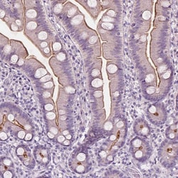 Invitrogen RAI3 Polyclonal Antibody 100 &mu;L; Unconjugated:Antibodies,