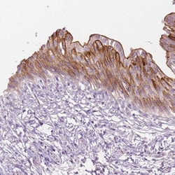 Invitrogen RAI3 Polyclonal Antibody 100 &mu;L; Unconjugated:Antibodies,