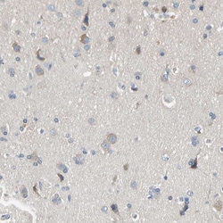 Invitrogen MARK1 Polyclonal Antibody:Antibodies:Primary Antibodies