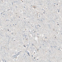 Invitrogen RON Polyclonal Antibody 100 &mu;L; Unconjugated:Antibodies,