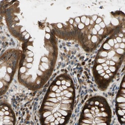 Invitrogen RON Polyclonal Antibody 100 &mu;L; Unconjugated:Antibodies,