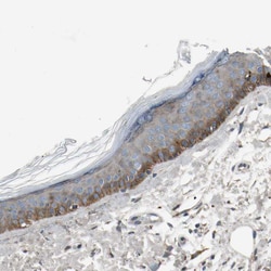 Invitrogen RON Polyclonal Antibody 100 &mu;L; Unconjugated:Antibodies,