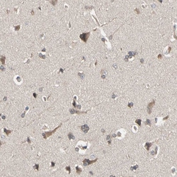 Invitrogen DPP8 Polyclonal Antibody 100 &mu;L; Unconjugated:Antibodies,