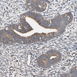 Invitrogen DPP8 Polyclonal Antibody 100 &mu;L; Unconjugated:Antibodies,
