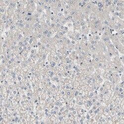 Invitrogen DPP8 Polyclonal Antibody 100 &mu;L; Unconjugated:Antibodies,
