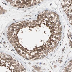 Invitrogen DPP8 Polyclonal Antibody 100 &mu;L; Unconjugated:Antibodies,