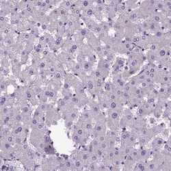 Invitrogen Amphiregulin Polyclonal Antibody 100 μL; Unconjugated:Antibodies,