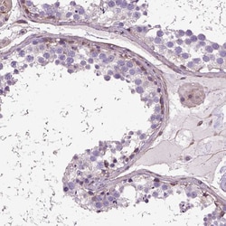 Invitrogen Amphiregulin Polyclonal Antibody 100 μL; Unconjugated:Antibodies,