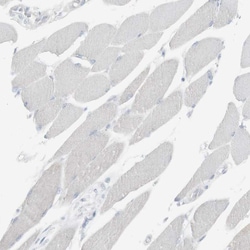 Invitrogen CD3z Polyclonal Antibody 100 &mu;L; Unconjugated:Antibodies,