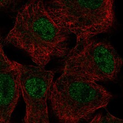 Invitrogen SGK2 Polyclonal Antibody 100 μL; Unconjugated:Antibodies,