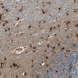 Invitrogen CNDP1 Polyclonal Antibody 100 &mu;L; Unconjugated:Antibodies,