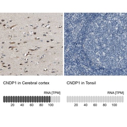 Invitrogen CNDP1 Polyclonal Antibody 100 &mu;L; Unconjugated:Antibodies,