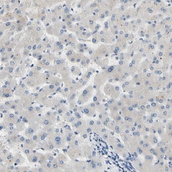 Invitrogen CNDP1 Polyclonal Antibody 100 &mu;L; Unconjugated:Antibodies,