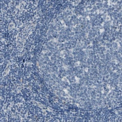 Invitrogen CNDP1 Polyclonal Antibody 100 &mu;L; Unconjugated:Antibodies,