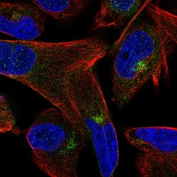 Invitrogen M-cadherin Polyclonal Antibody 100 &mu;L; Unconjugated:Antibodies,