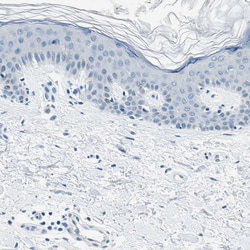 Invitrogen M-cadherin Polyclonal Antibody 100 &mu;L; Unconjugated:Antibodies,