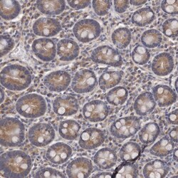 Invitrogen CEP104 Polyclonal Antibody 100 &mu;L; Unconjugated:Antibodies,
