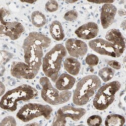 Invitrogen ETNK1 Polyclonal Antibody 100 &mu;L; Unconjugated:Antibodies,