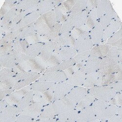 Invitrogen ETNK1 Polyclonal Antibody 100 &mu;L; Unconjugated:Antibodies,