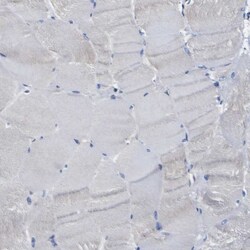 Invitrogen Caspase 6 Polyclonal Antibody 100 μL; Unconjugated:Antibodies,