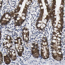 Invitrogen Caspase 6 Polyclonal Antibody 100 μL; Unconjugated:Antibodies,