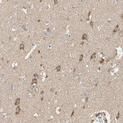 Invitrogen DKK3 Polyclonal Antibody 100 μL; Unconjugated:Antibodies,